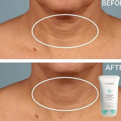 Crema Venzen® Reafirmante con rodillo que necesitas todos los días.